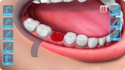 医生修个牙好玩吗