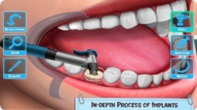医生修个牙怎么通关